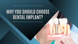 Why You Should Choose Dental Implant?