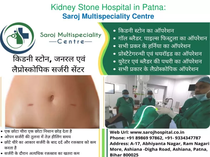 kidney stone hospital in p atna saroj