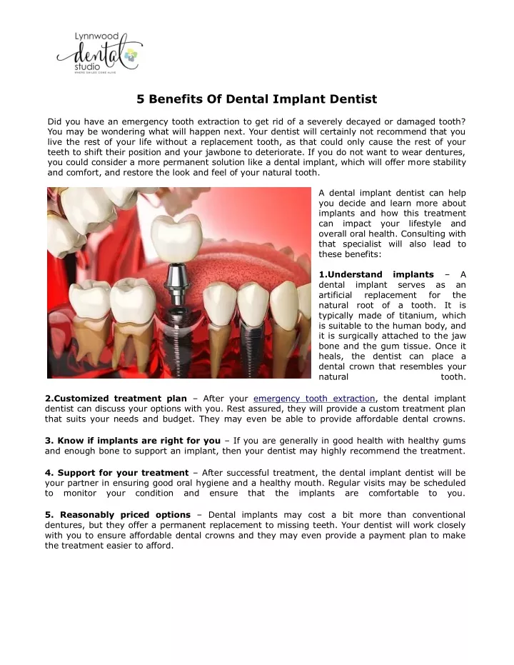 5 benefits of dental implant dentist
