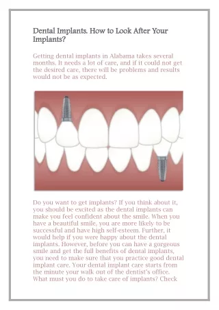 dental dental implants implants how implants