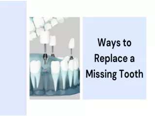 Ways to Replace a Missing Tooth