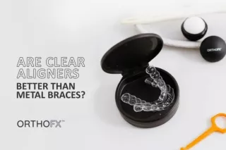 Are Clear Aligners Better Than Metal Braces? | Teeth Straightening | OrthoFX