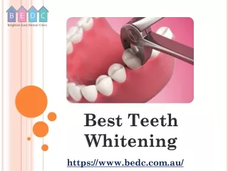 best teeth whitening