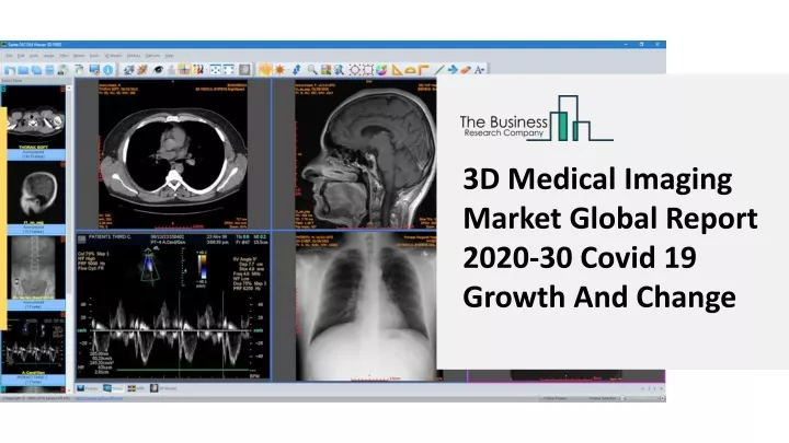 3d medical imaging market global report 2020