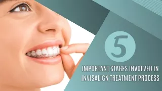 5 Important Stages Involved in Invisalign Treatment Process