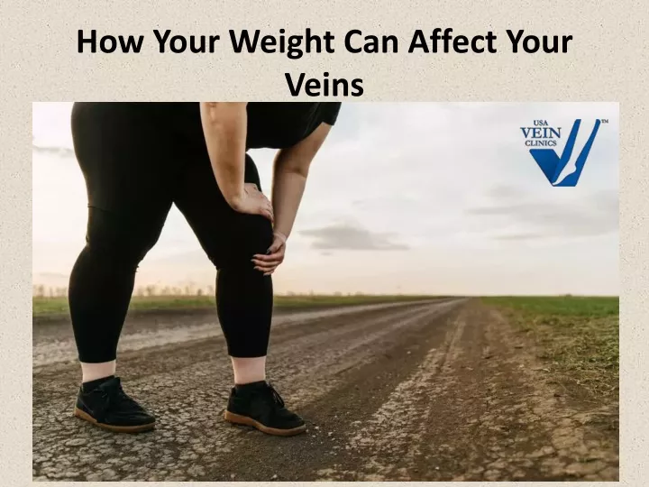 how your weight can affect your veins