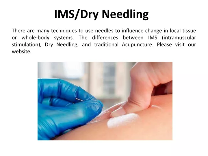 ims dry needling