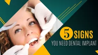 5 Signs You Need Dental Implant
