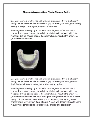 Choose Affordable Clear Teeth Aligners Online