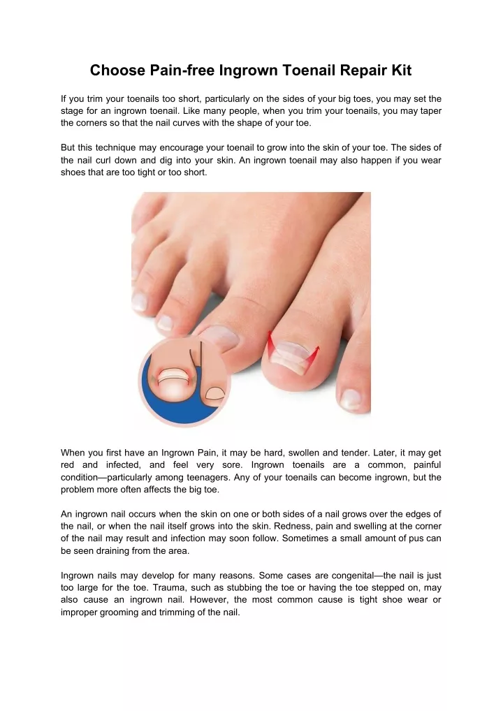 choose pain free ingrown toenail repair kit