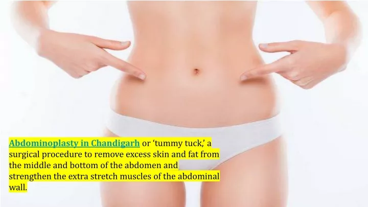 abdominoplasty in chandigarh or tummy tuck