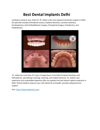 Best Dental Implants Delhi