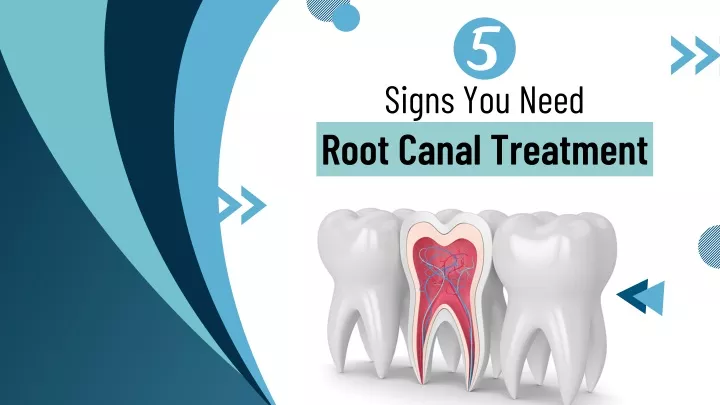 signs you need root canal treatment