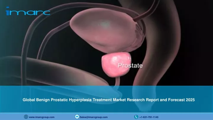global benign prostatic hyperplasia treatment