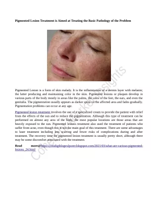 pigmented lesion treatment is aimed at treating