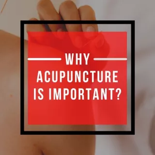 Strategic Points On Acupuncture