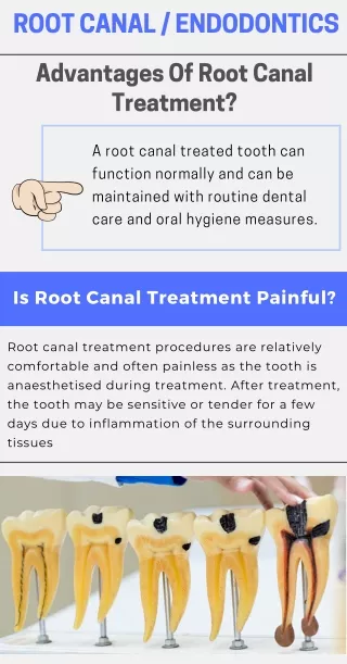 Cost Effective Root Canal Therapy