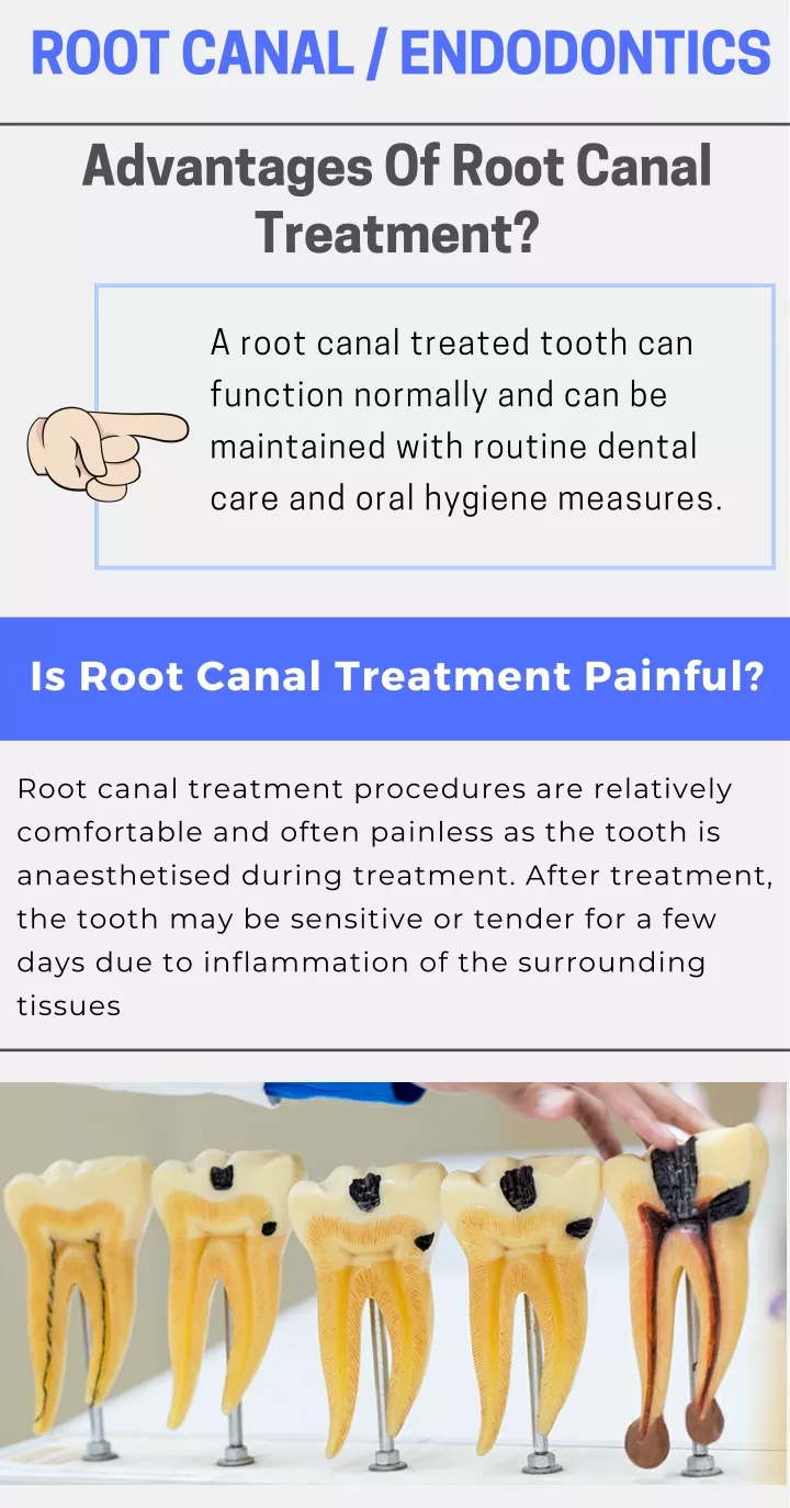 root canal endodontics