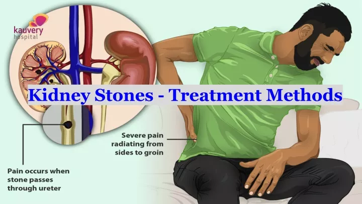kidney stones treatment methods