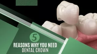 5 Reasons Why You Need Dental Crown
