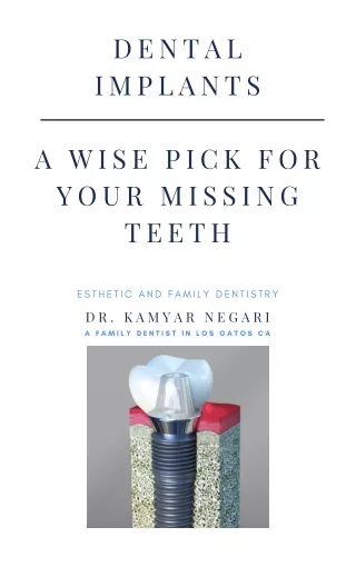 Dental Implants - Gold Standard For Your Missing Teeth | Los Gatos California