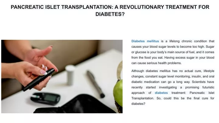 pancreatic islet transplantation a revolutionary