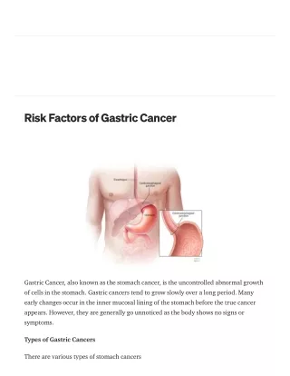 Risk Factors of Gastric Cancer