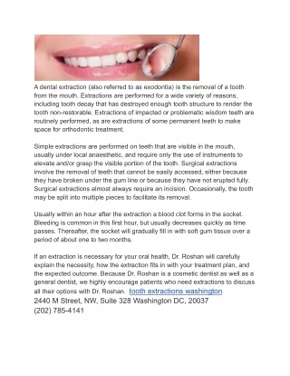tooth extractions washington