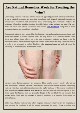 are natural remedies work for treating the veins