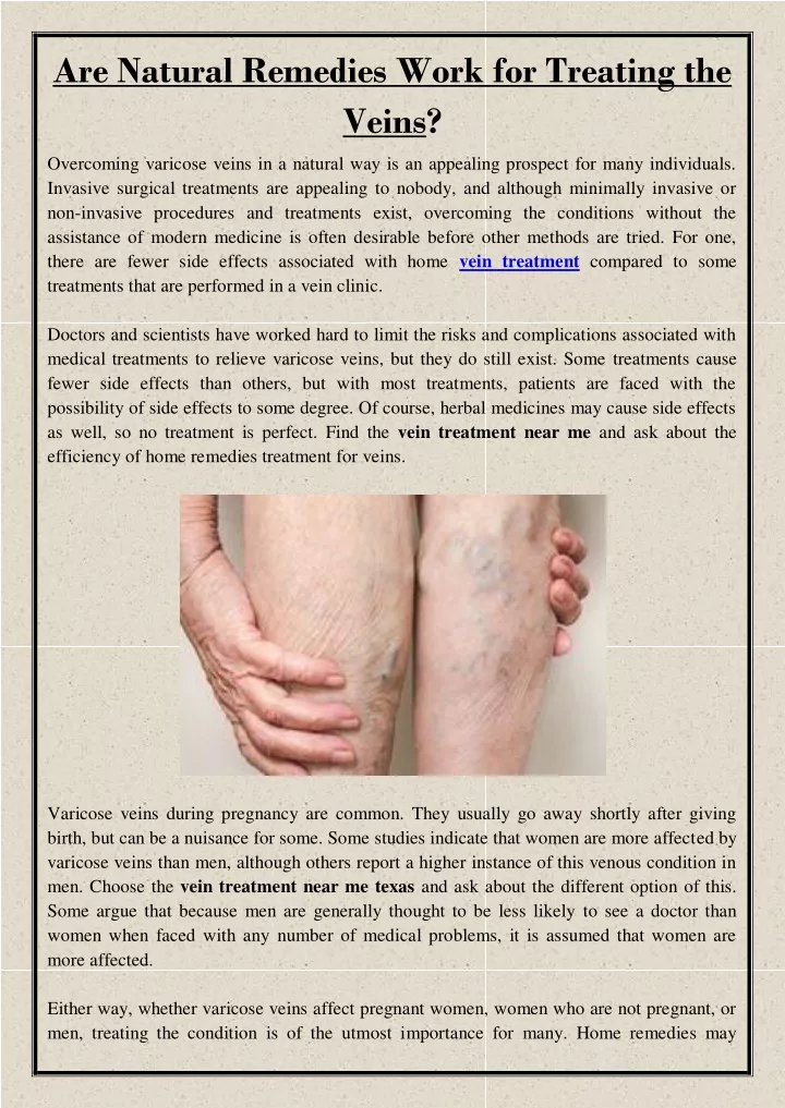 are natural remedies work for treating the veins