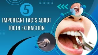 5 Important Facts About Tooth Extraction