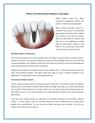 Where to Get Best Dental Implants in San Diego