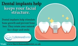 Dental implants help keeps your facial structure.