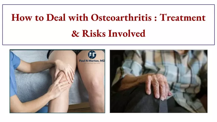 how to deal with osteoarthritis treatment risks involved