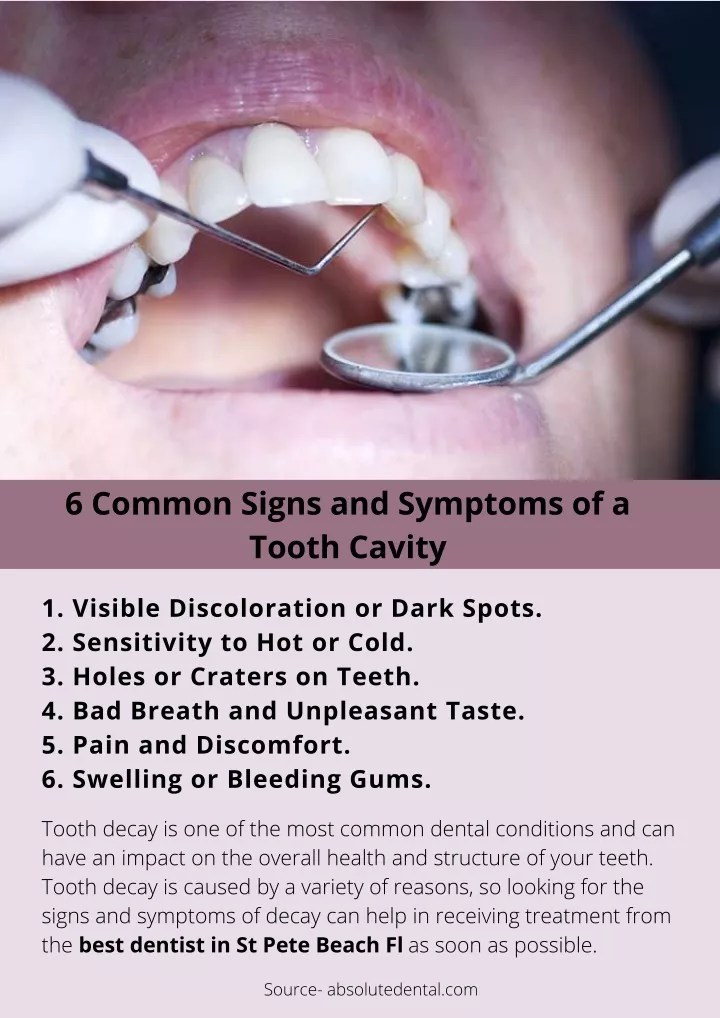 6 common signs and symptoms of a tooth cavity