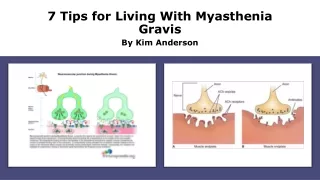 7 tips for living with myasthenia gravis