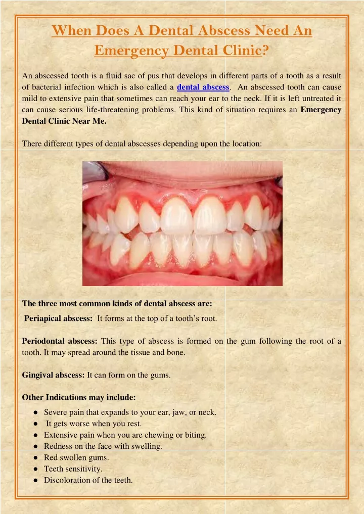 when does a dental abscess need an emergency