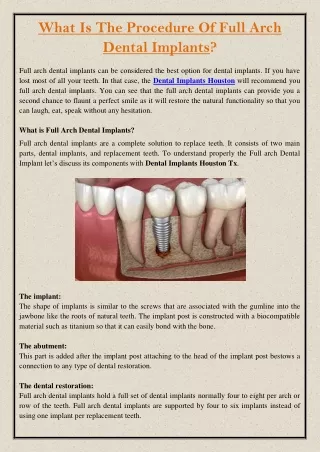 what is the procedure of full arch dental implants