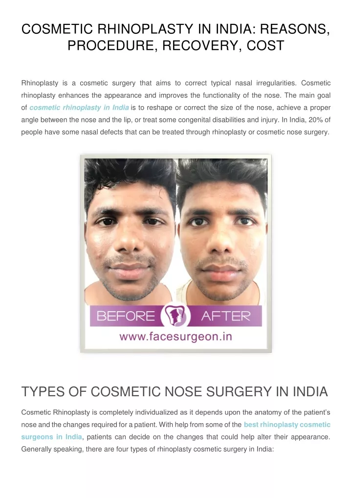 cosmetic rhinoplasty in india reasons procedure