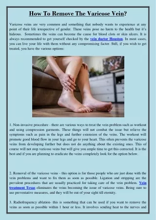 how to remove the varicose vein