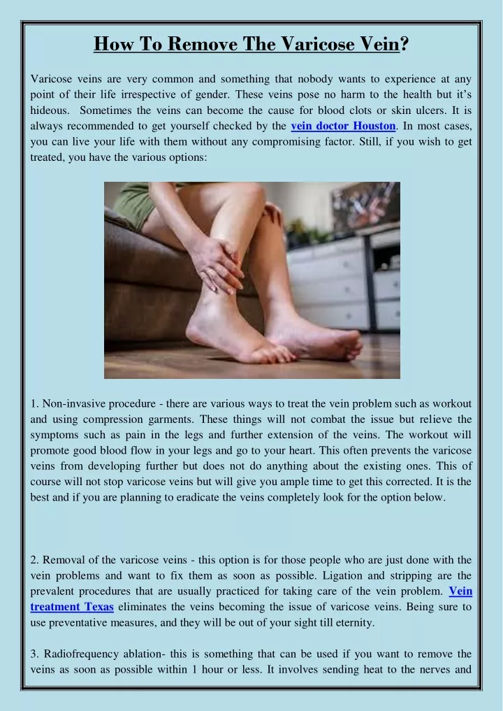 how to remove the varicose vein