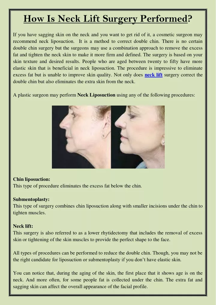how is neck lift surgery performed