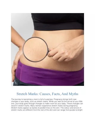 Stretch Marks: Causes, Facts, And Myths - The Moms Co.