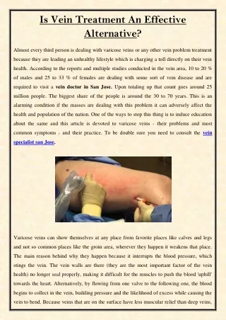 is vein treatment an effective alternative