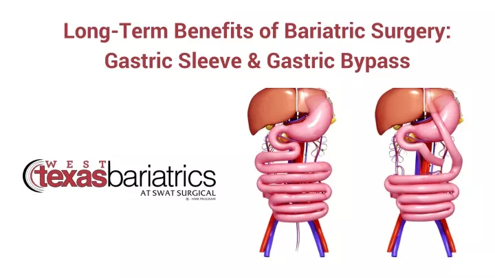 long term benefits of bariatric surgery gastric