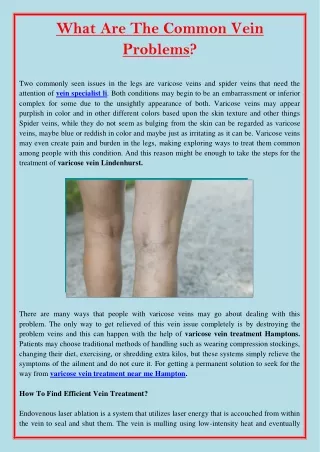 what are the common vein problems