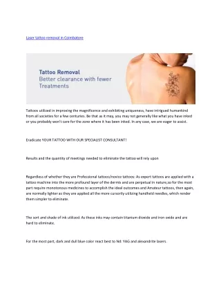 Laser tattoo removal in Coimbatore