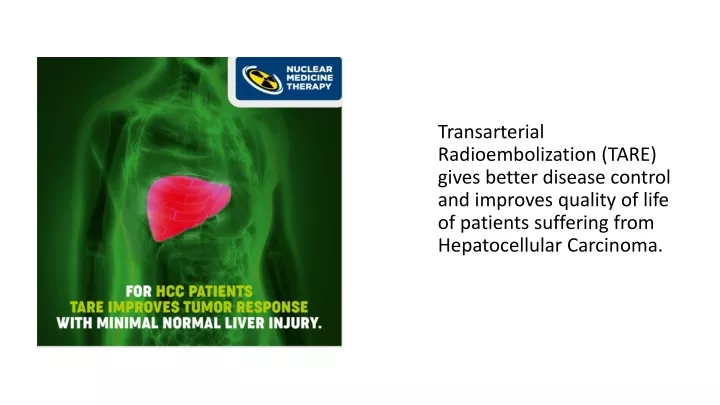 transarterial radioembolization tare gives better