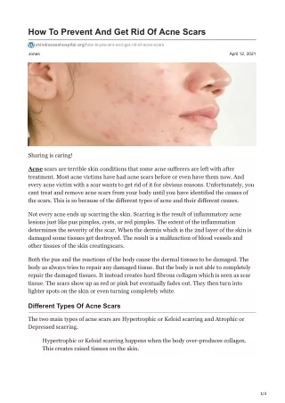 how to prevent and get rid of acne scars