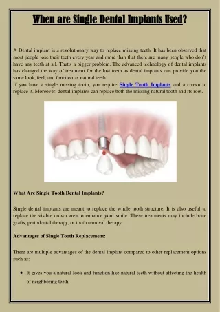 when are single dental implants used when